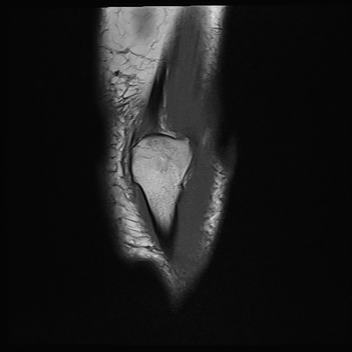 Click on the Serie image to view the images of Wieszt, Gnter